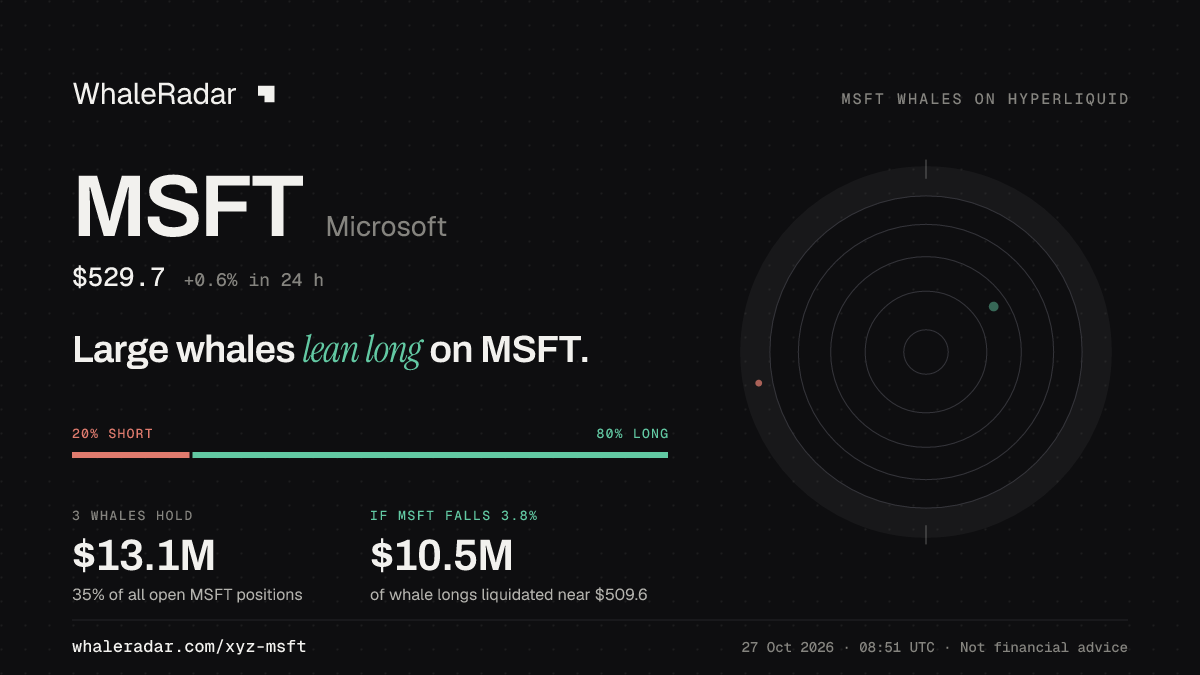 MSFT 공유 카드: 대형 고래, MSFT 롱 우세.